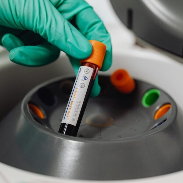 Hematology Analyzers