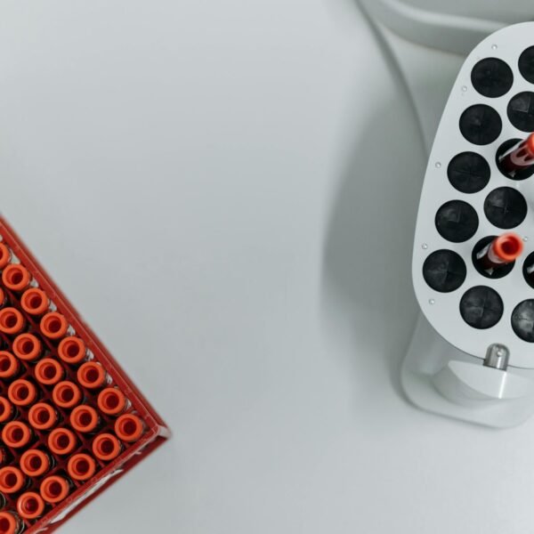 Top view of blood sample tubes in a laboratory centrifuge, essential for medical research.